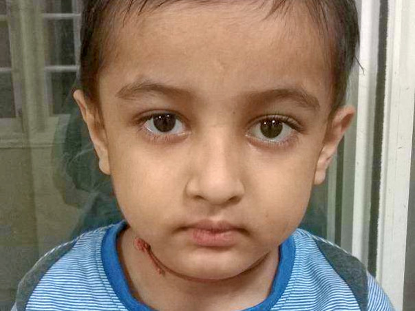 Help Baby Boy Manav Thakor For Bone Marrow Transplant