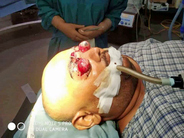 Anup needs your help