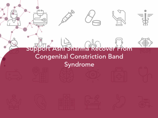 Support Ashi Sharma Recover From Congenital Constriction Band Syndrome