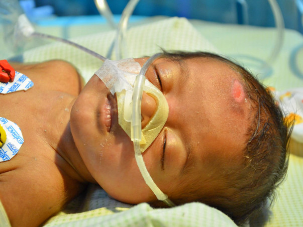3-Month-Old Baby Girl Suffering From Rare Lung Disease Needs Help