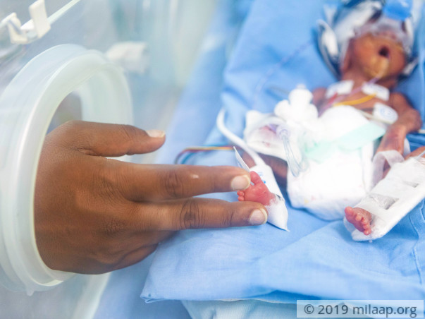 Pharmacist Needs Urgent Help To Save His Premature Baby
