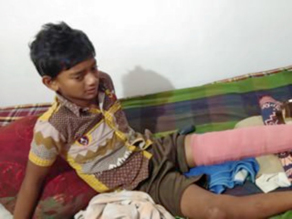 Help My Watchman's Young Child Raise Funds For His Broken Leg