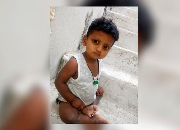 Save My 2-Year-Old Son From A Serious Liver Condition