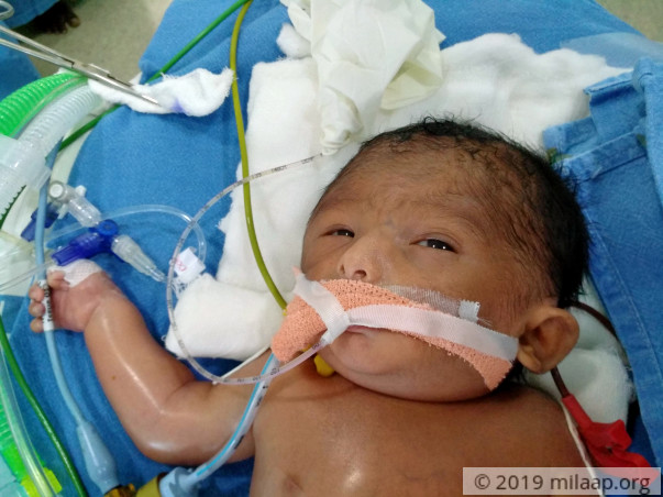 Help Sushma and Kranthi save their 4 day old baby boy