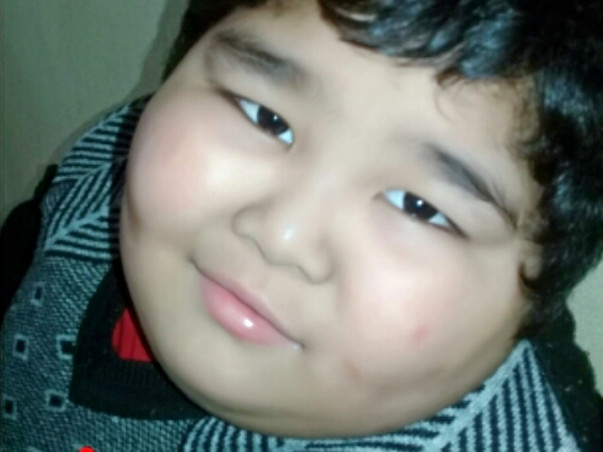 Help My Son With Down Syndrome