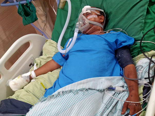 Please Help Yogendra Recover From Traumatic Zygomatic Fracture