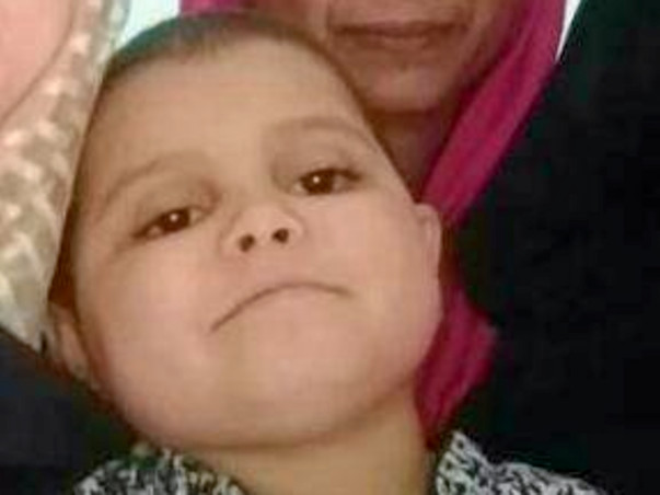 Help Ayesha Fight Suprasellar Meningioma