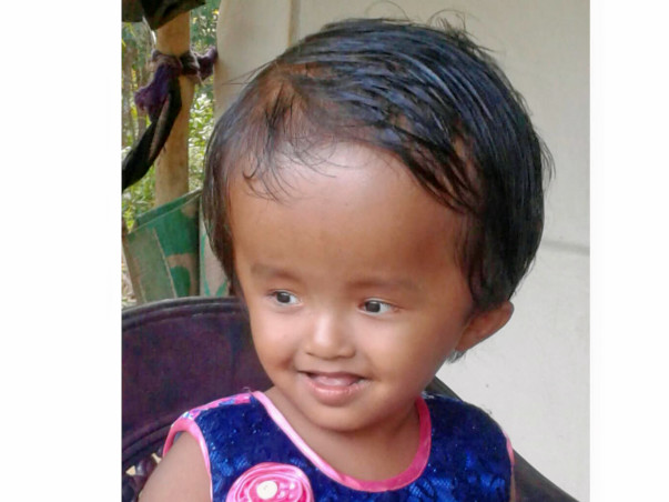 Help Little Reshmi Fight Hydrocephalus