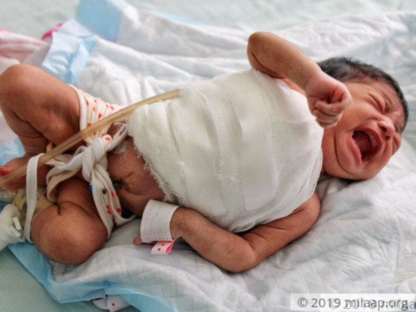 An Aggressive Flesh-Eating Disease Will Kill This 1-Month-Old Baby