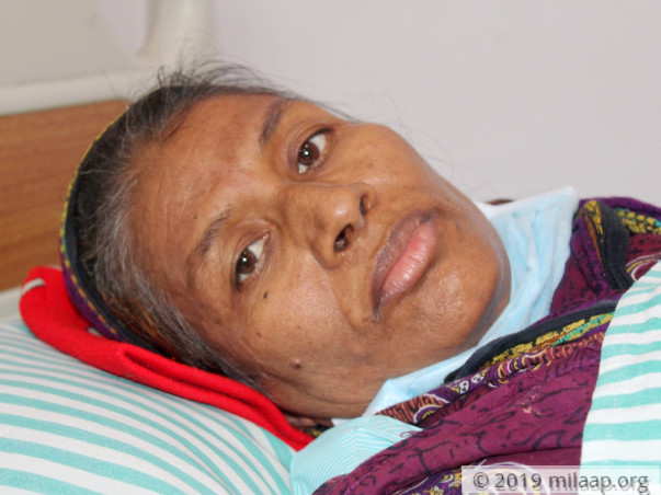 Haseena Begum Acute Myeloid Leukemia