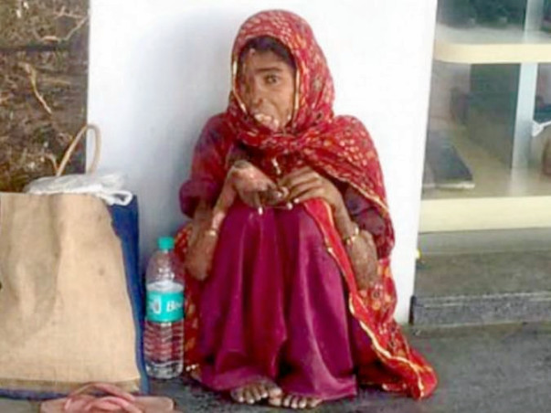 Help Ritu Roy ( An acid attack victim) from CP find her lost life