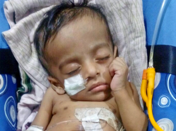 This Baby requires a surgery so that he can eat through his mouth