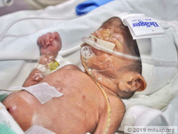 Baby of Latha needs your help to survive