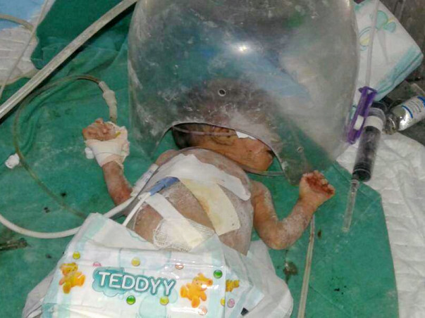 HELP PRITI'S TWIN BABIES