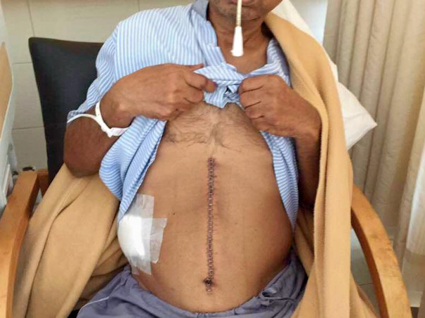 Help Sanjay To Fight Cancer
