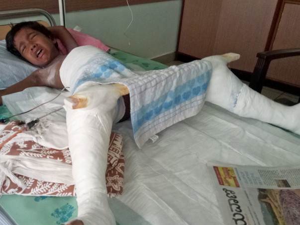 Help For My Daughter's Dislocated Hip Surgery