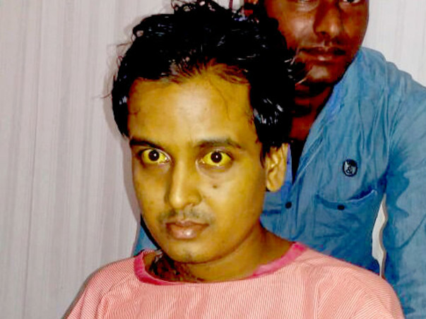Help 24-Year-Old Uddalok To Fight Back After Liver Transplant Surgery