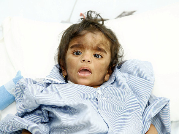 This 1-year-old boy needs a bone marrow transplant to survive