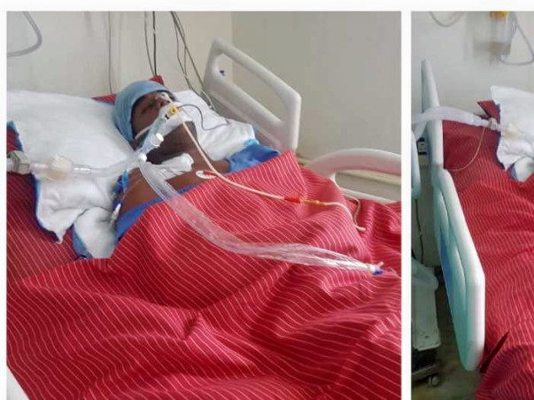 Help Kishore Kumar from Brain Clotting