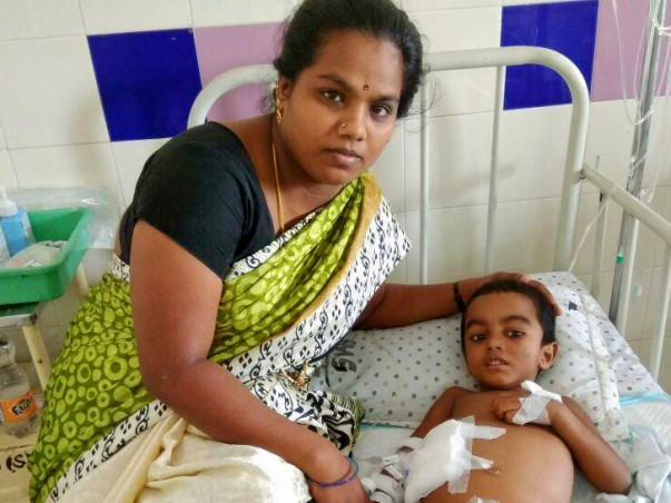 Even After 6 Surgeries This 3-Year-Old Is Nowhere Safe From Death