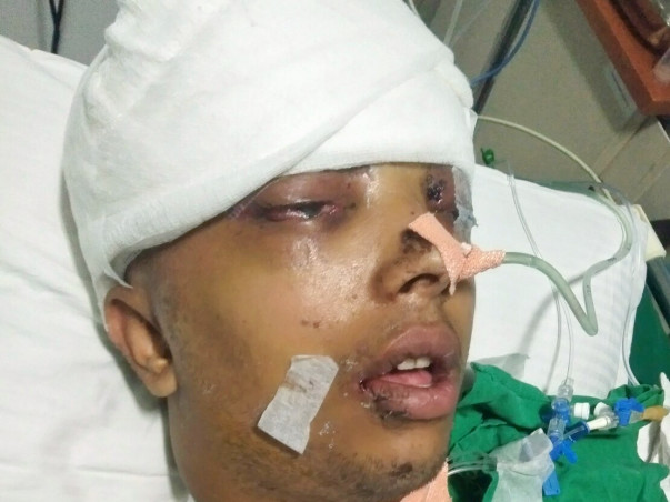 Help Mahesh Recover From A Major Accident