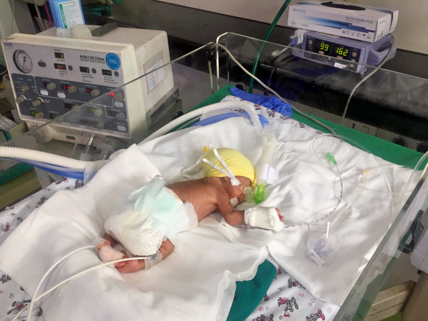 Bala's Twins Are Struggling To Live And He Has Noone For Support