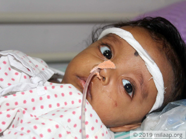 5-Month-Old Chokes Every Time He Cries Because Of Cancerous Tumour