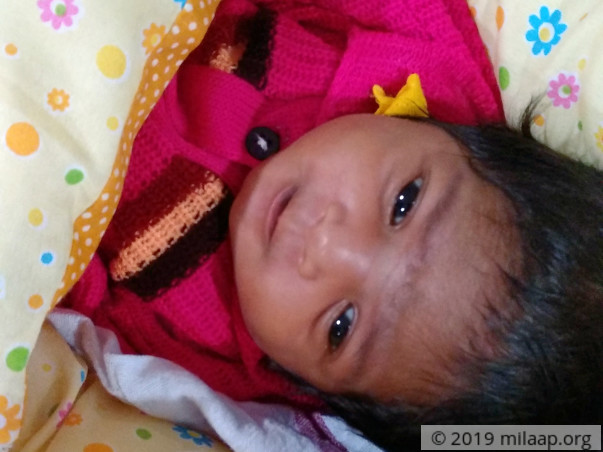 Baby Born Without Major Valve In Heart Is Gasping For Every Breath