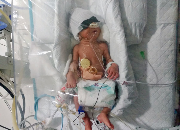 Nilam's New-Born Twins Need Your Help Funding Their Treatment