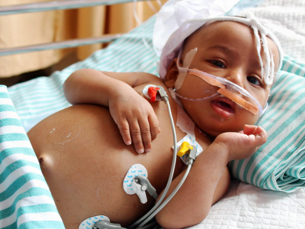 Large Tumor Has Damaged This 9-Month-Old’s Liver Completely