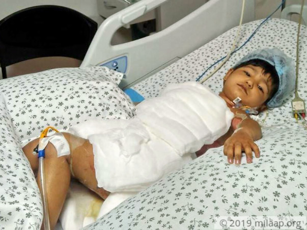 2-Year Old Is In The ICU After Falling Into A Bucket Of Boiling Water
