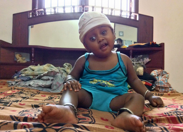 Baby Nidarshan Needs An Urgent Surgery To Replace His Skull