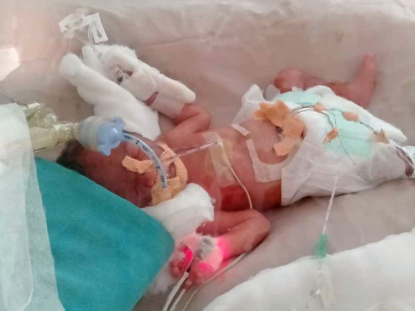 Help Critical Pre term Twin babies in NICU
