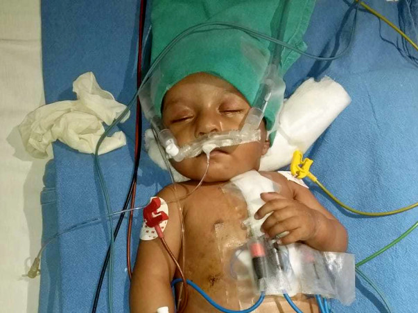 Help Baby Sudeep Kumar Pandey