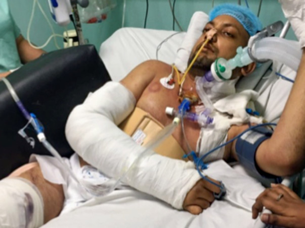 Help Kumar Anand To Fight Against A Severe Brain Injury