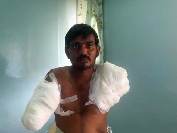 Help Rama - An Electric Line Man Who Lost Both Hands While On Duty!
