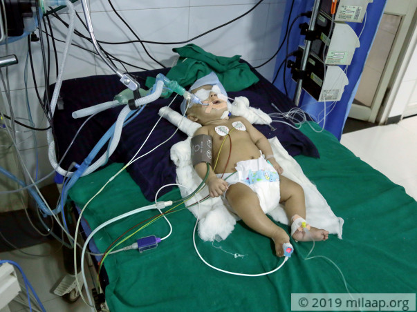 You Can Save This 4-Month-Old Baby Boy From Brain Damage
