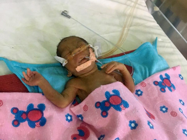 Help New Born Premature Baby to Survive