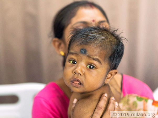 Help Mother Who Worries She Might Wake Up To A Dead Baby