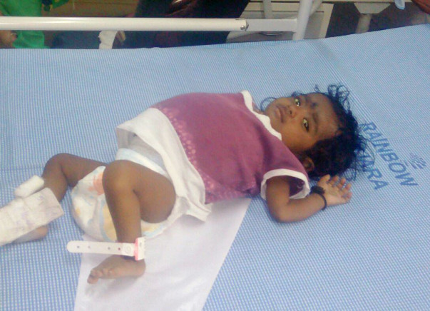 10-month-Old Rithvika Cries Herself To Sleep Every Single Night
