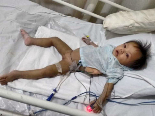 Save Rachel: HELP 10 month old baby from Manipur with fluid in Lungs.