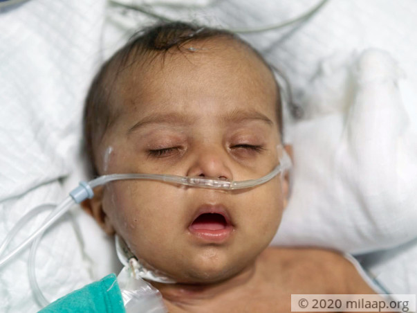 Help Baby of Chandra Shakar Recover From Pneumonia