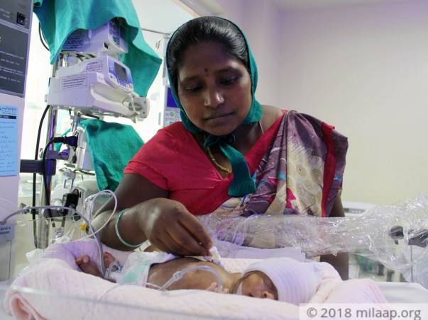 Helpless Mother Is Struggling To Save Premature Baby Born