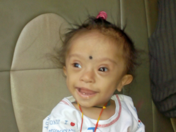 Help Baby Rudraksha For His Heart Surgery