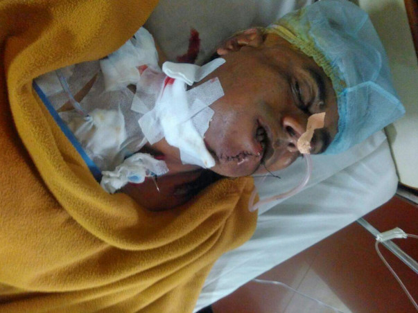 Help My Uncle Ashwinbhai fight Against Mouth Cancer