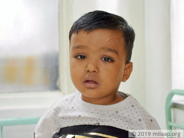 Help Shaurya Pardeshi Fight Biliary Atresia