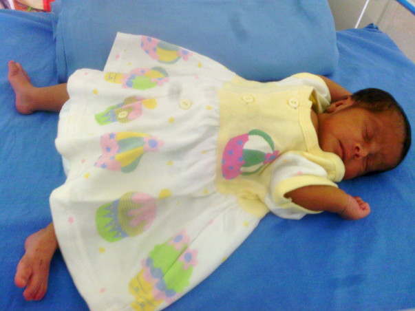 Please help treat Alagu's premature baby daughter