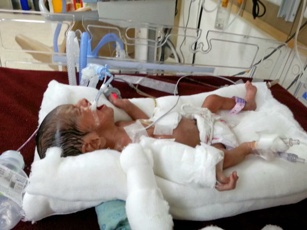 2 Wks Old Baby is Critically Ill & On Ventilator Needs Your Help