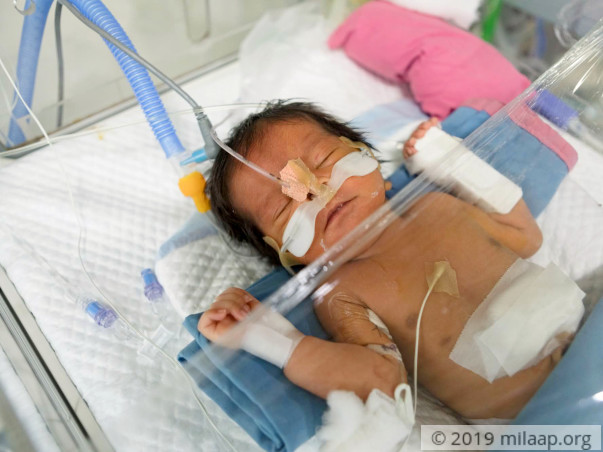 Help Swathi's Preterm Baby Survive