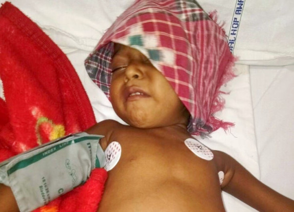 Help this 4-year-old fight chronic liver disease